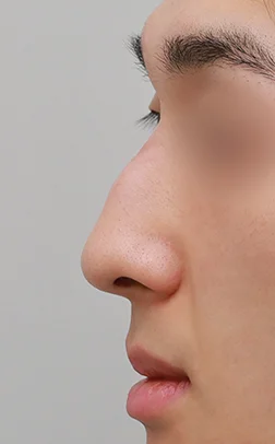 01. 굴곡형